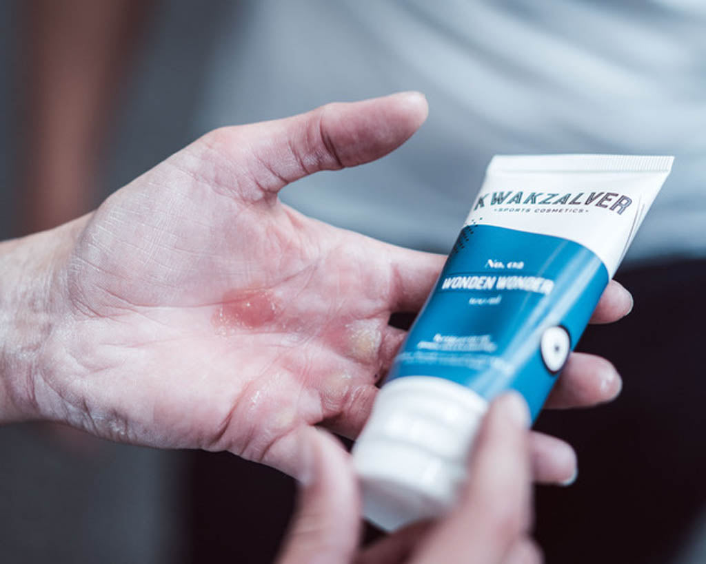 Wonden Wonder 75 ml gel