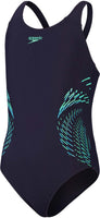 Eco Plastisol Placement Muscleback badpak